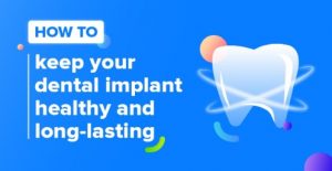 Keeping dental implants healthy