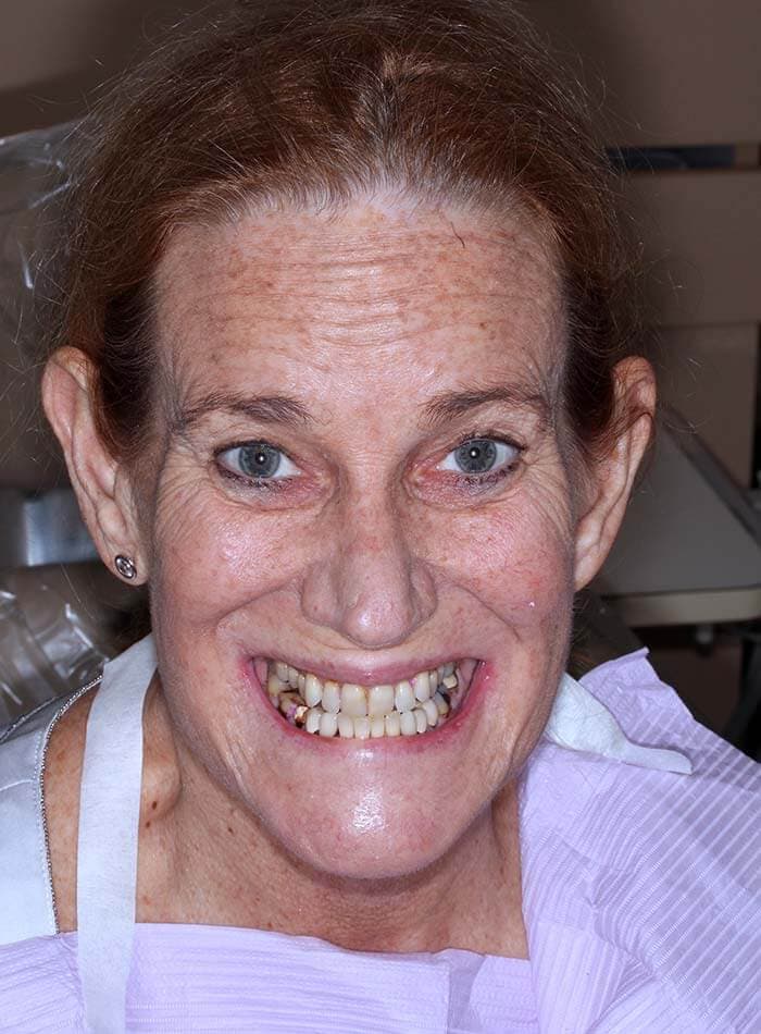 before treatment