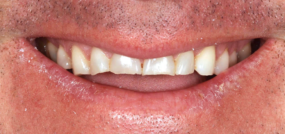 before treatment
